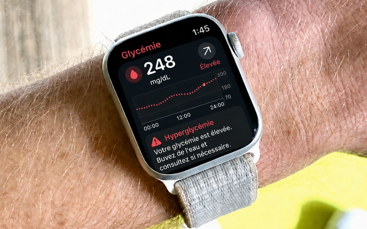 Apple Watch : vers un suivi de la glycémie plus simple pour les diabétiques  ?