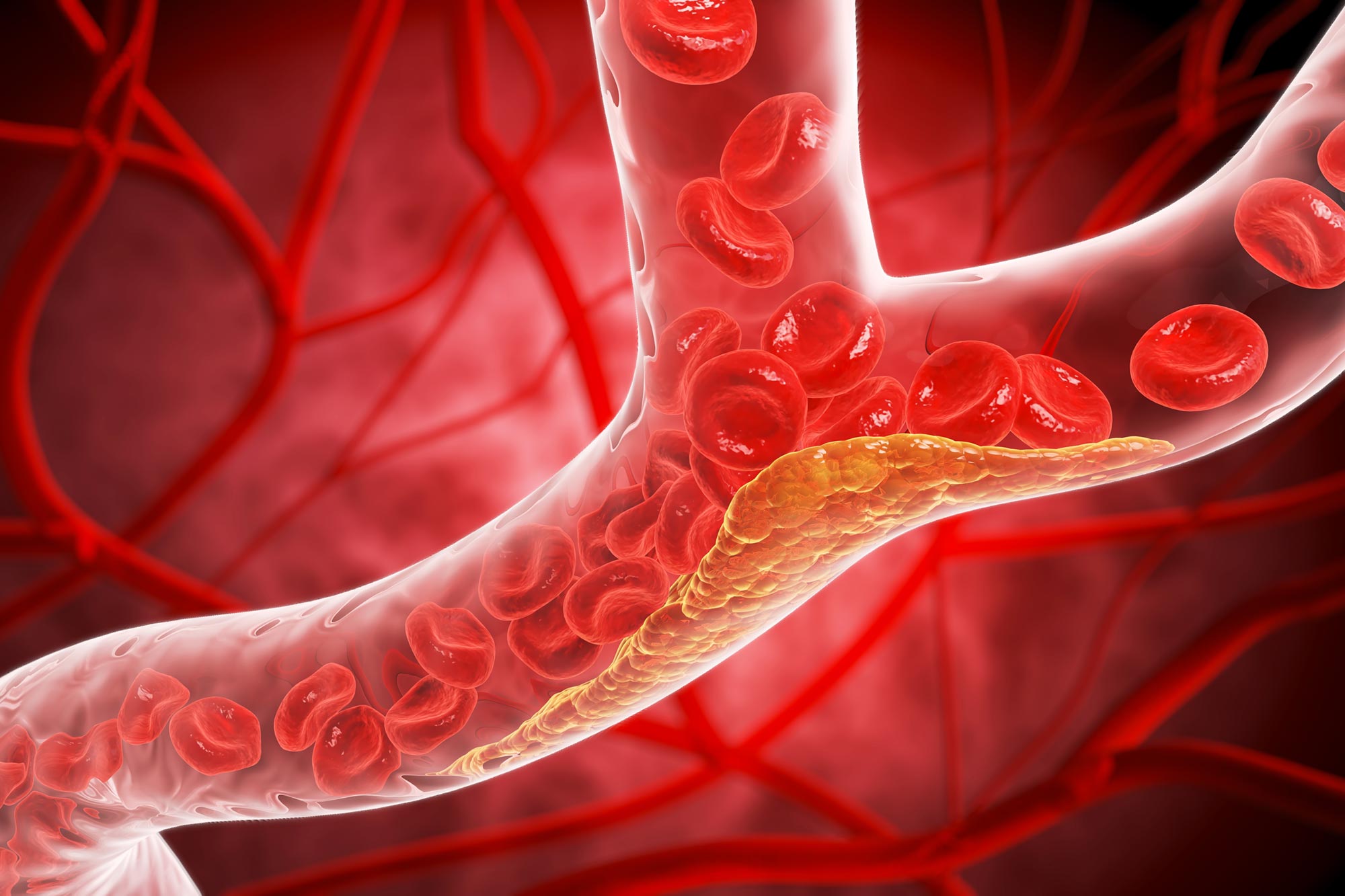 New Pill Slashes “Bad” Cholesterol by 60%