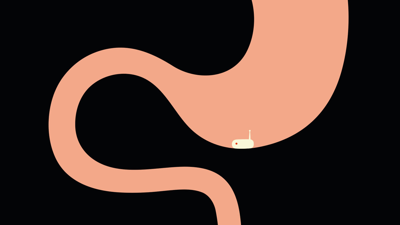 Tomorrow's medical sensors might come served with dinner