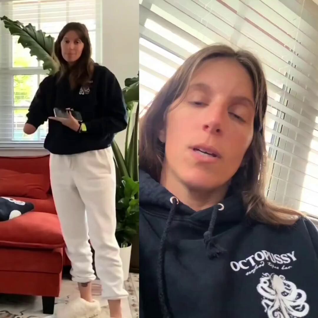 Une femme a reçu une amende pour avoir utilisé son téléphone avec sa main  droite en conduisant, alors qu'elle est amputée de ce bras... 🤡 « Il  s'avère qu'on peut encore prendre