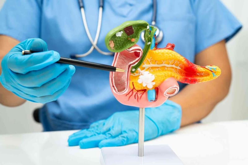 Cancer du pancréas : un nouveau médicament double la survie à un an