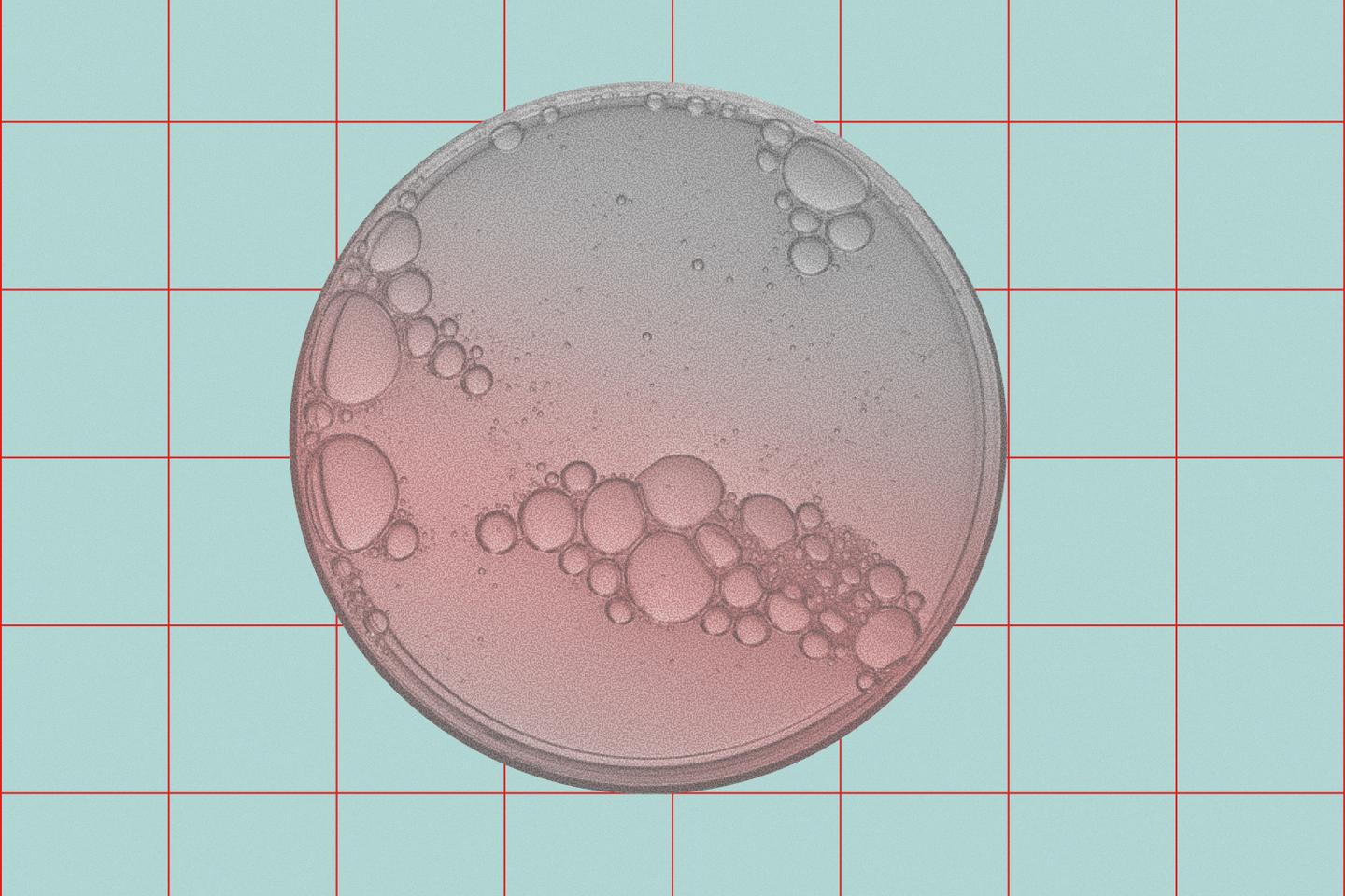 Quand peut-on arrêter les immunothérapies des cancers ?