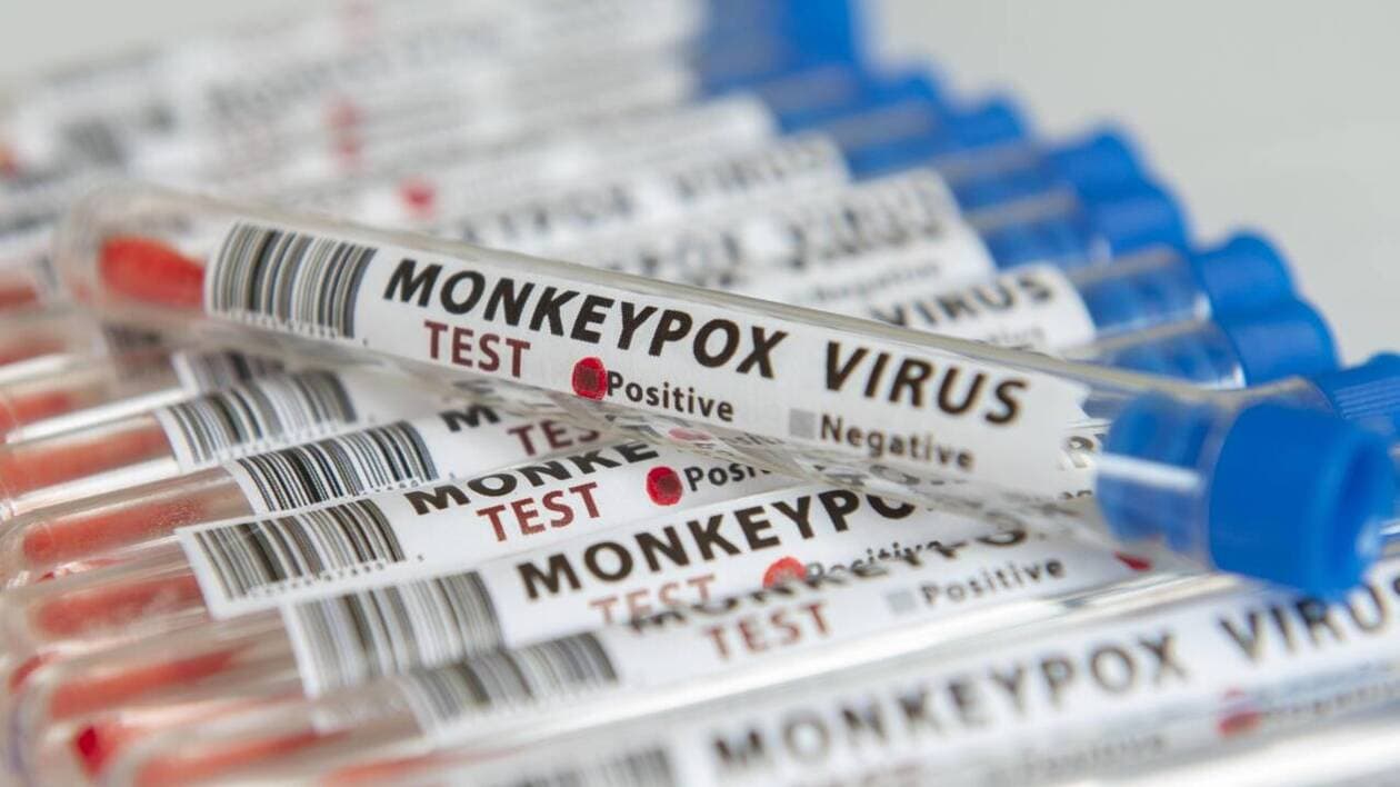 Deux virologues inculpés aux États-Unis pour avoir tenté d'importer le  virus mpox depuis le Congo-Brazzaville