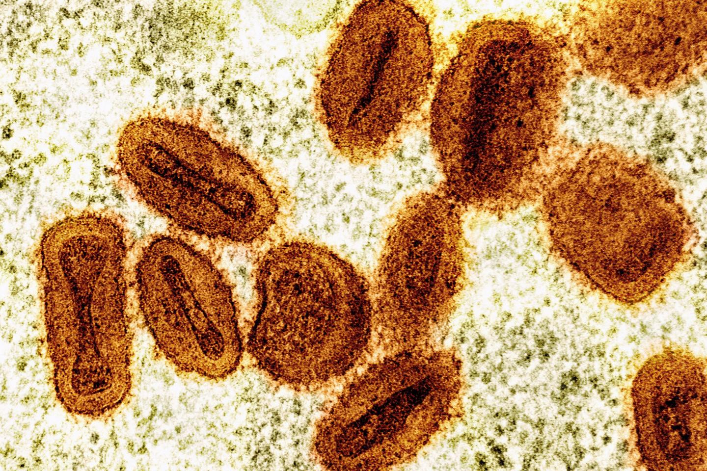 Deux virologues inculpés aux Etats-Unis pour avoir tenté d'importer le  virus monkeypox d'Afrique