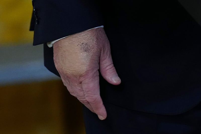 Trump subira un nouveau bilan de santé fin mai, annonce la Maison-Blanche