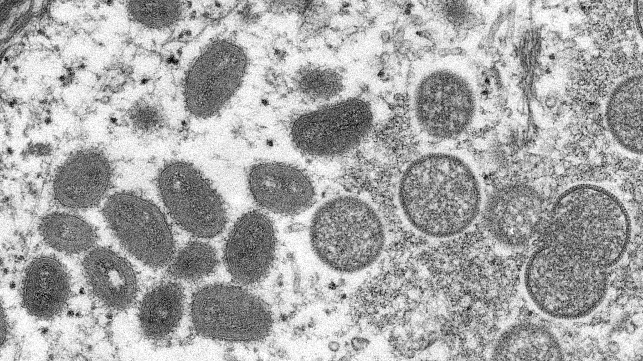 Deux virologues inculpés aux États-Unis pour avoir tenté d'importer le  virus mpox d'Afrique