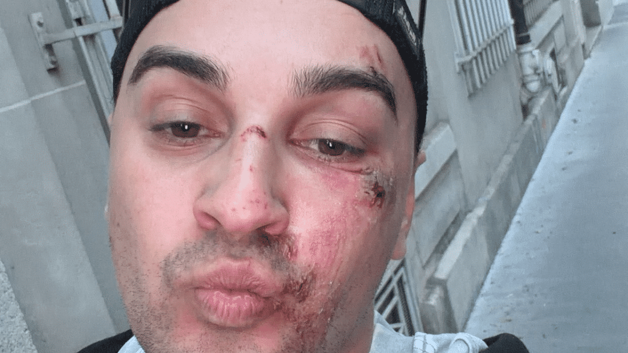 TEMOIGNAGE. "J'ai cru qu'ils allaient me tuer" : un influenceur victime  d'une agression homophobe en plein Paris