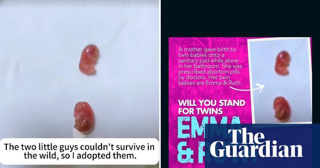 Image of 'twin babies' used by anti-abortion activist appears to show sugar  gliders | Guardian Australia : r/australia