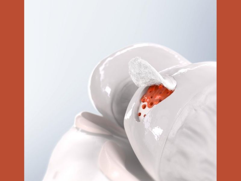 La laine : un nouvel allié pour la régénération osseuse en médecine
