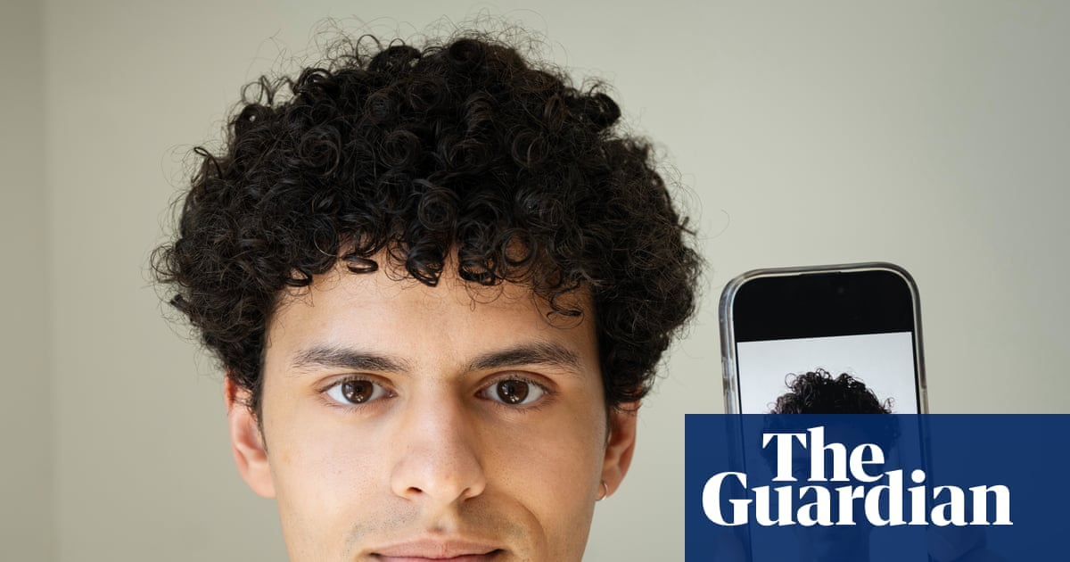 The Guardian: AI face panic: patients show up with AI-glam selfies,  expecting Tony Stark-level noses. EU surgeons warn: beauty bots aren't a  surgery manual. Keep your filters, not your expectations.