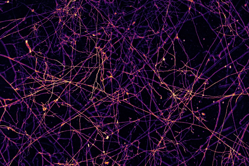 La première cartographie du réseau souterrain mondial des champignons a été  révélée | La Relève et La Peste