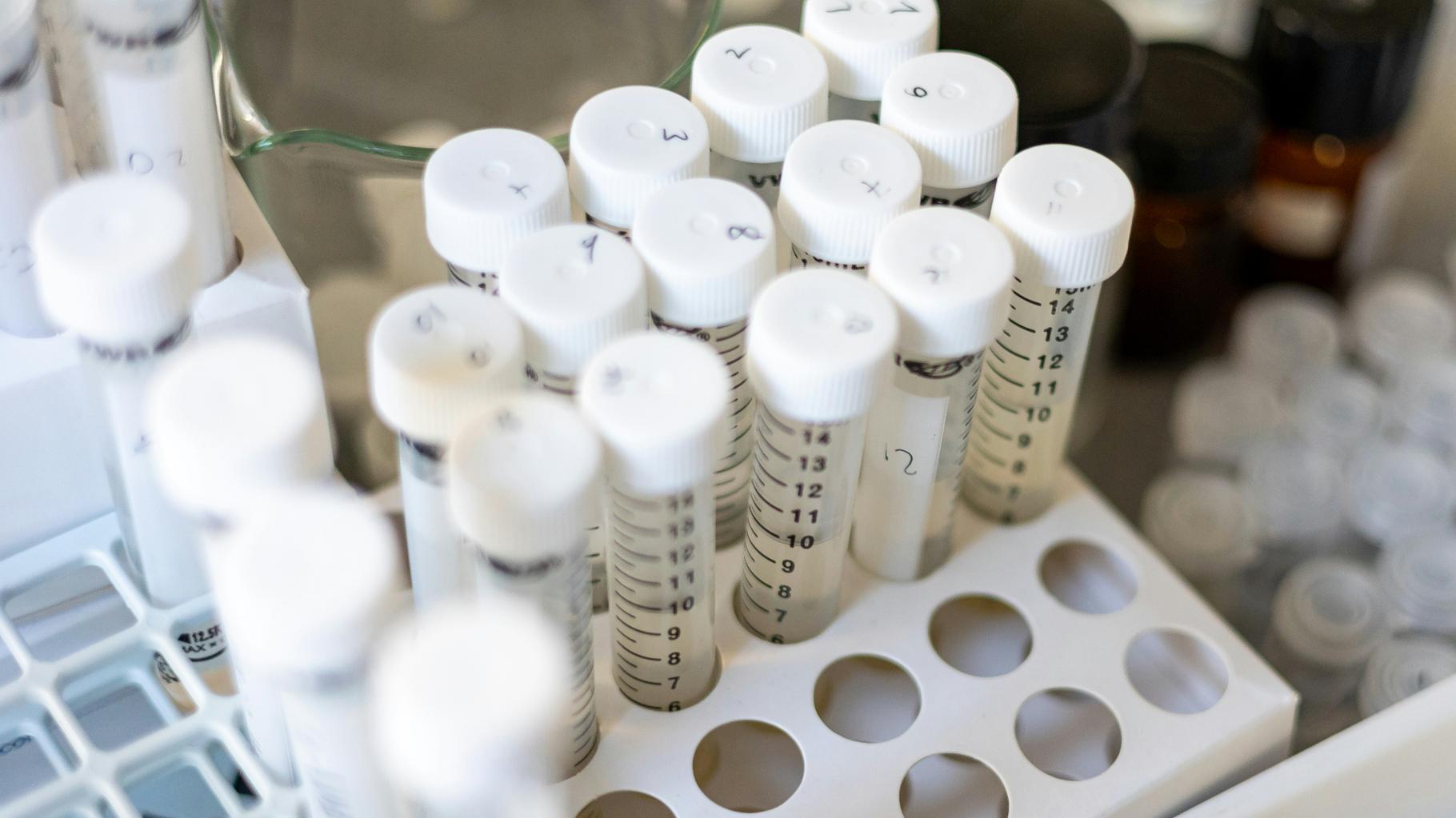 Le test de dépistage du cadmium sera bientôt remboursé en France, voilà qui  sera concerné