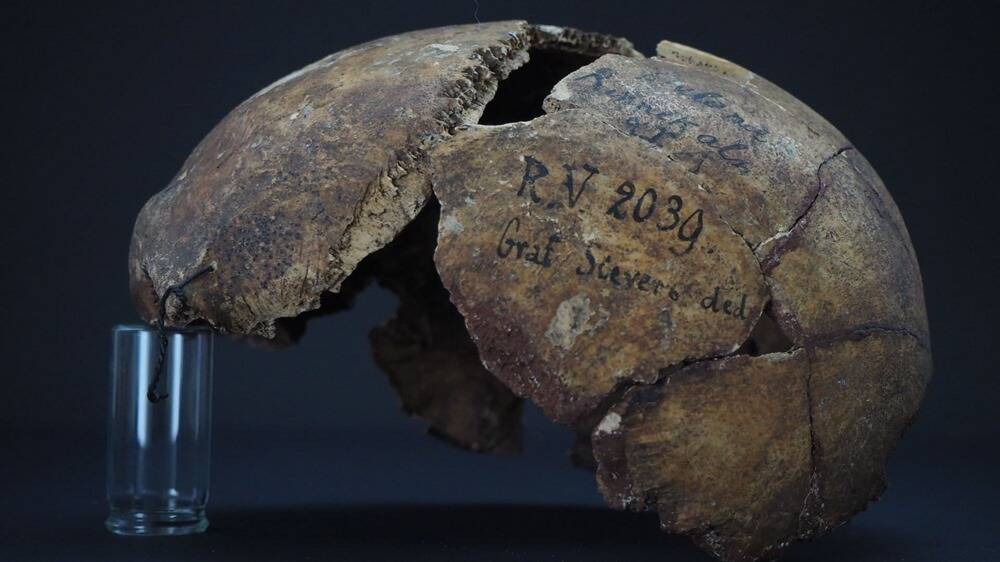 La plus ancienne victime de la peste vivait au Néolithique, il y a 5'000 ans  - Heidi.news