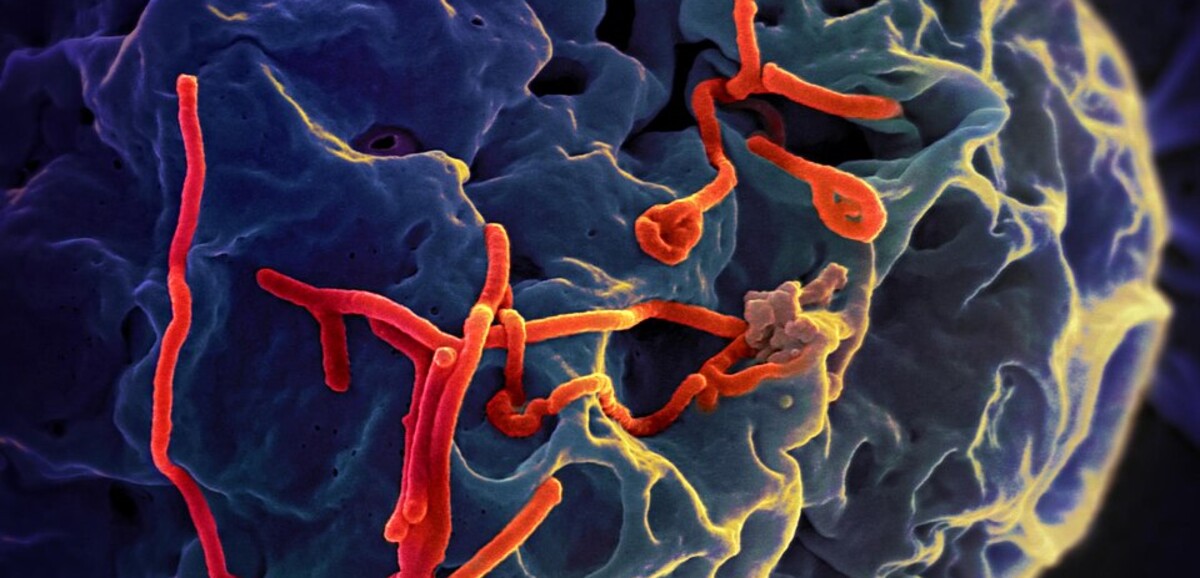 RDC. L'épidémie d'Ebola dépasse les 1.000 cas et 250 décès, selon le bilan  officiel