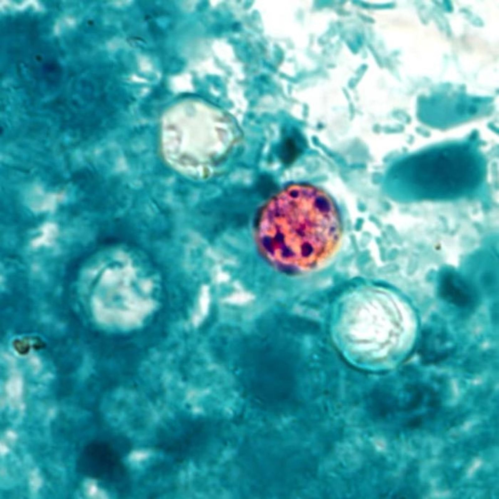 Qu'est-ce que la cyclosporose, cette infection parasitaire qui provoque des diarrhées explosives ? | National Geographic | National Geographic