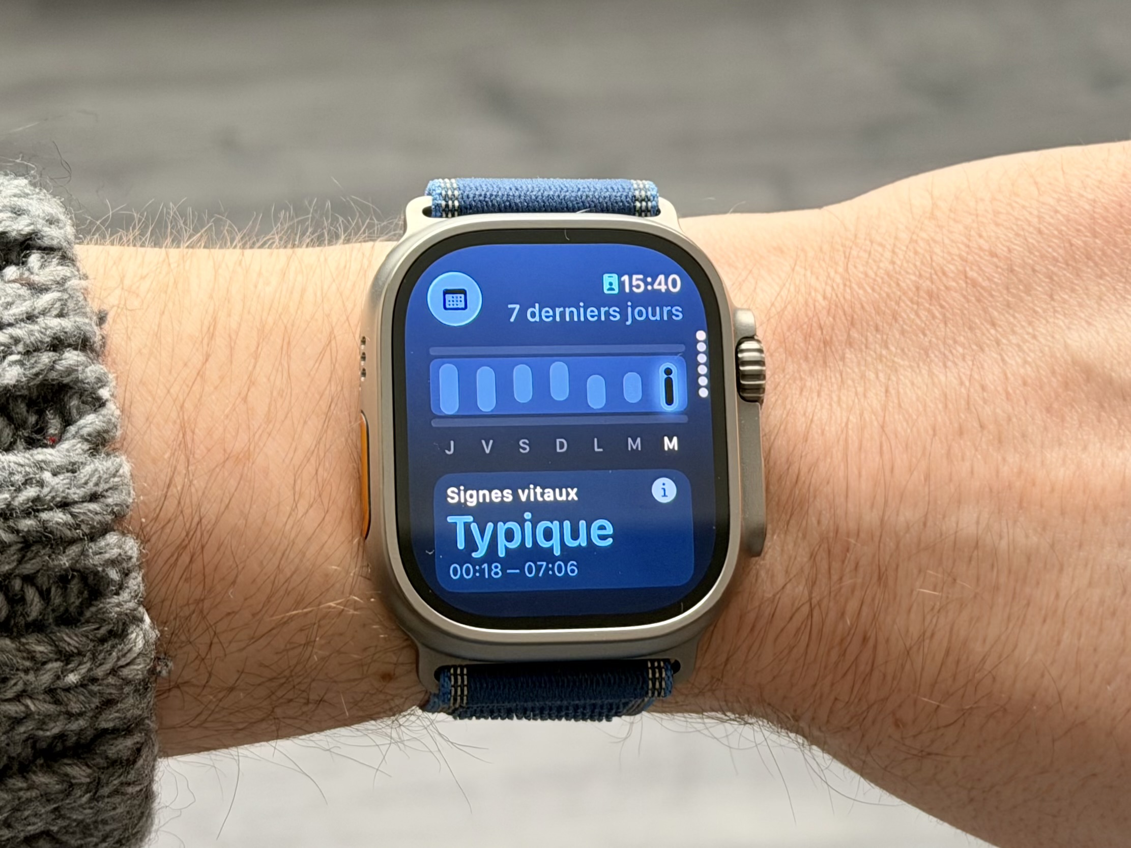 Apple Watch : nouveau patron pour le projet glycémie
